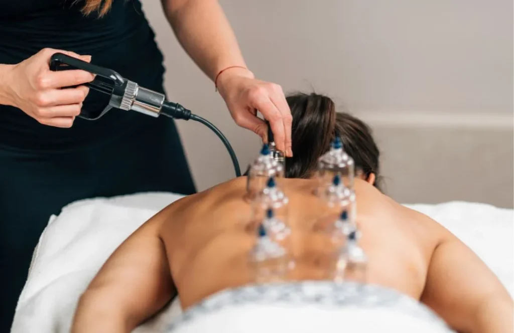 Cupping Therapy